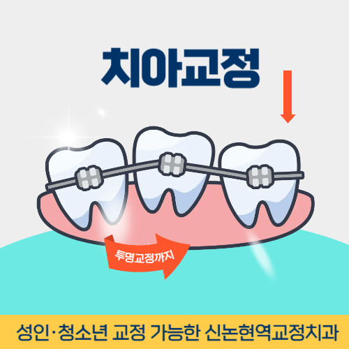여수치과 여수시 치과 치아교정