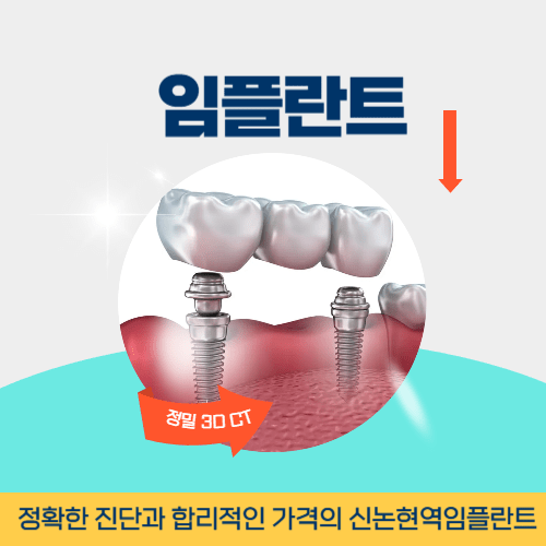 여수치과 여수시 치과 임플란트