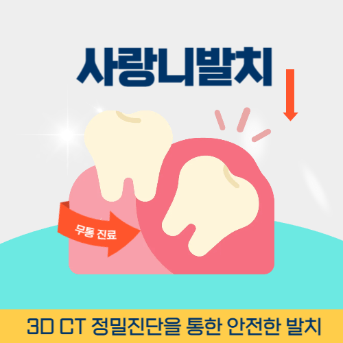여수치과 여수시 치과 사랑니 발치