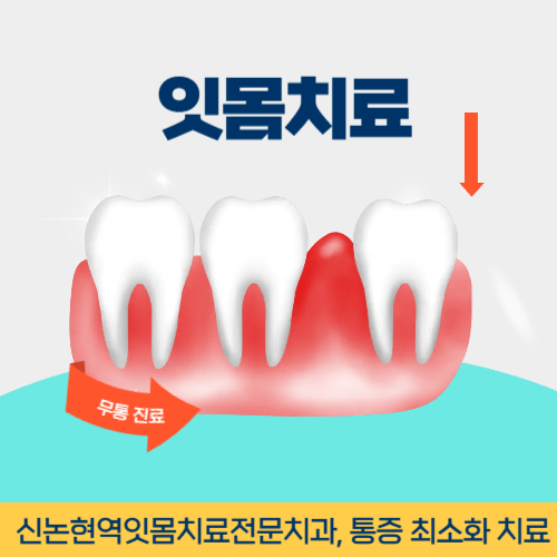 여수치과 여수시 치과 잇몸치료